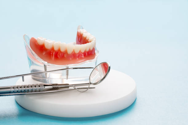 Full Mouth Reconstruction in Davis, CA